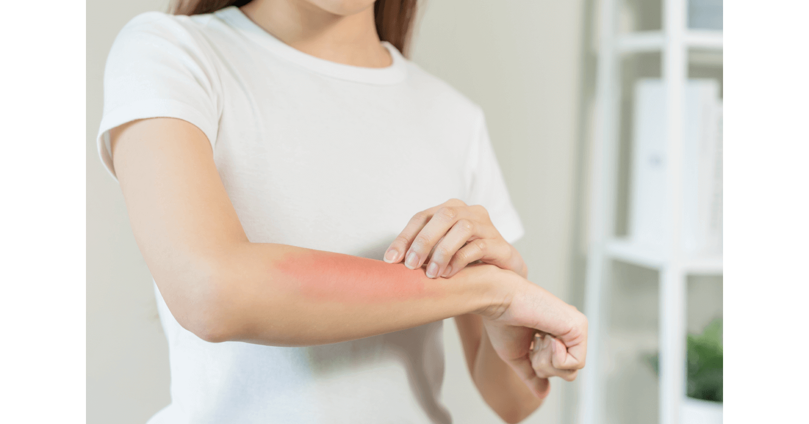 insect-bite-allergy-types-and-symptoms