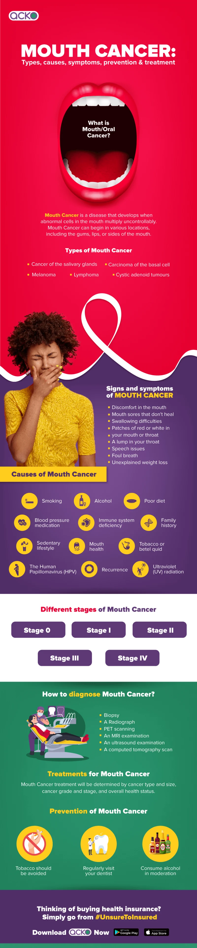 Oral Cancer or Mouth Cancer