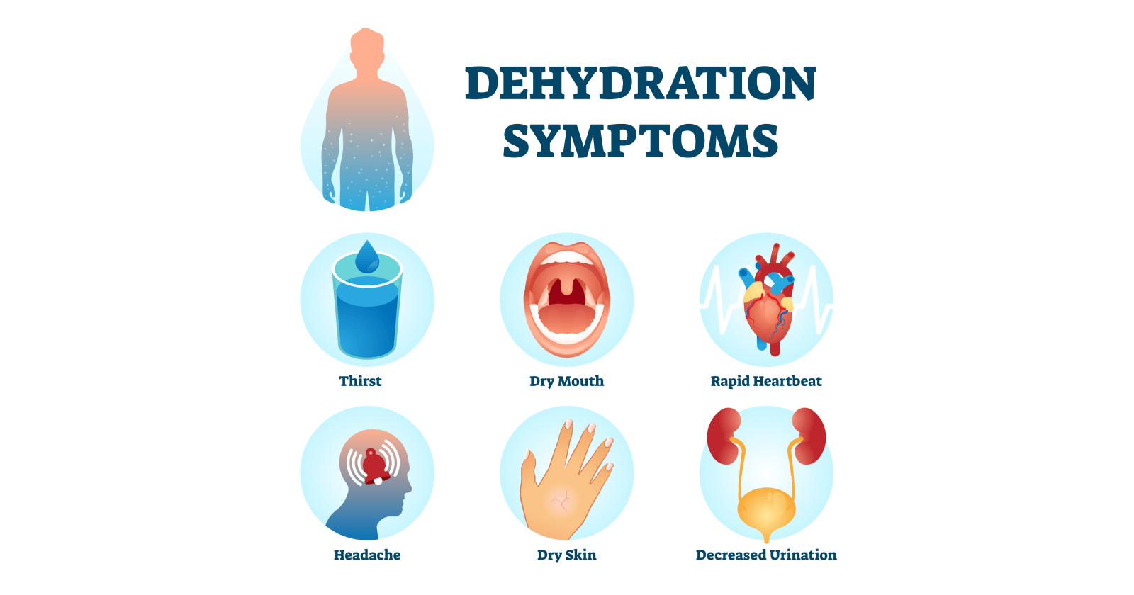 Dehydration: Symptoms, Causes, Prevention and Treatments