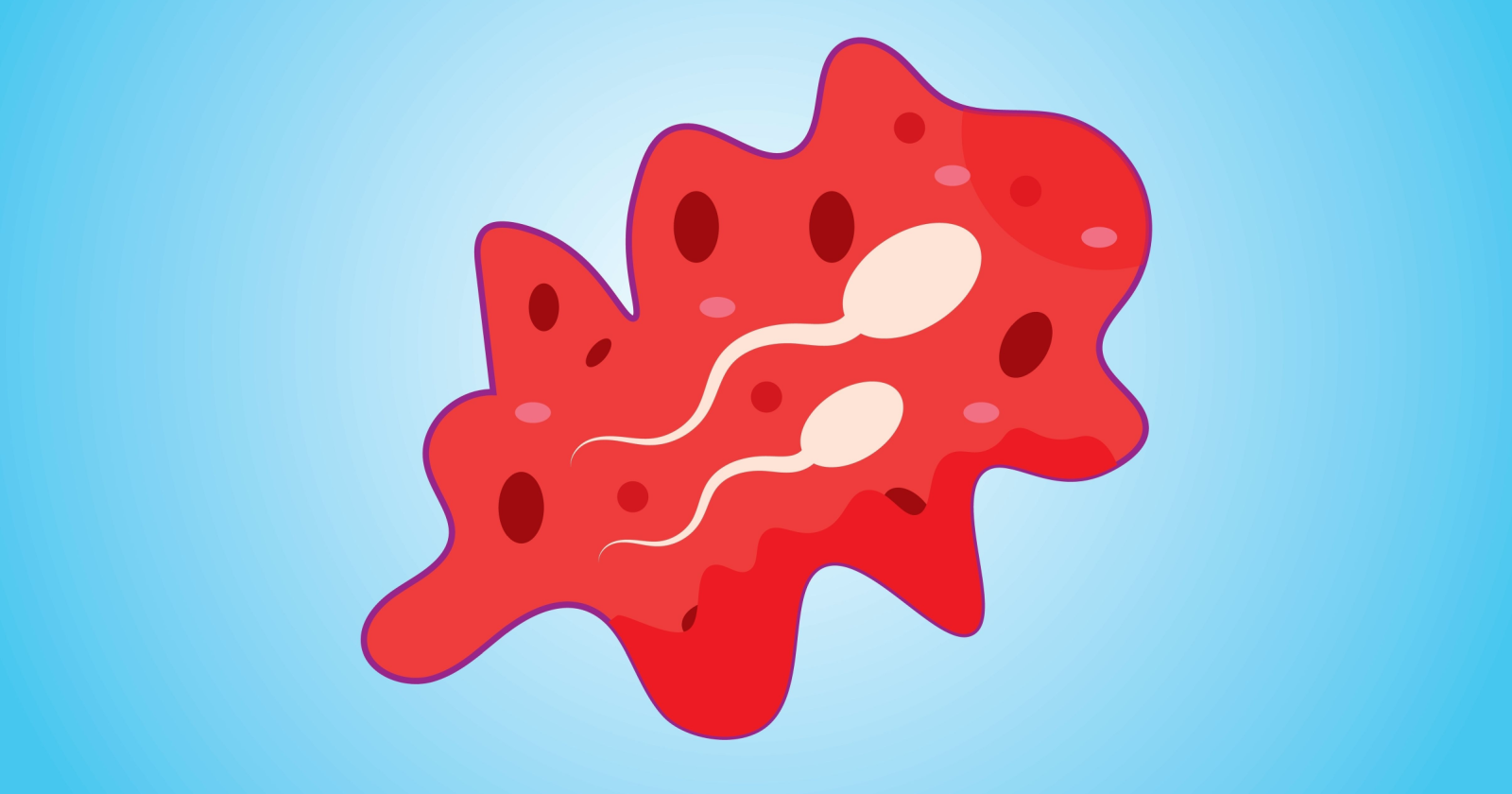 Blood in Semen (Hematospermia) Causes & Treatment