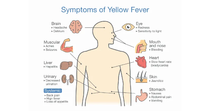 Symptoms of Yellow Fever
