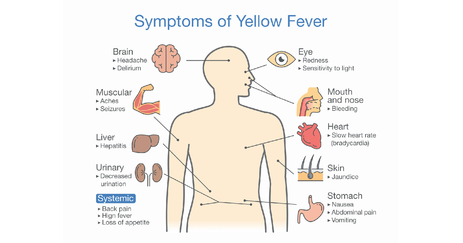 Symptoms of Yellow Fever