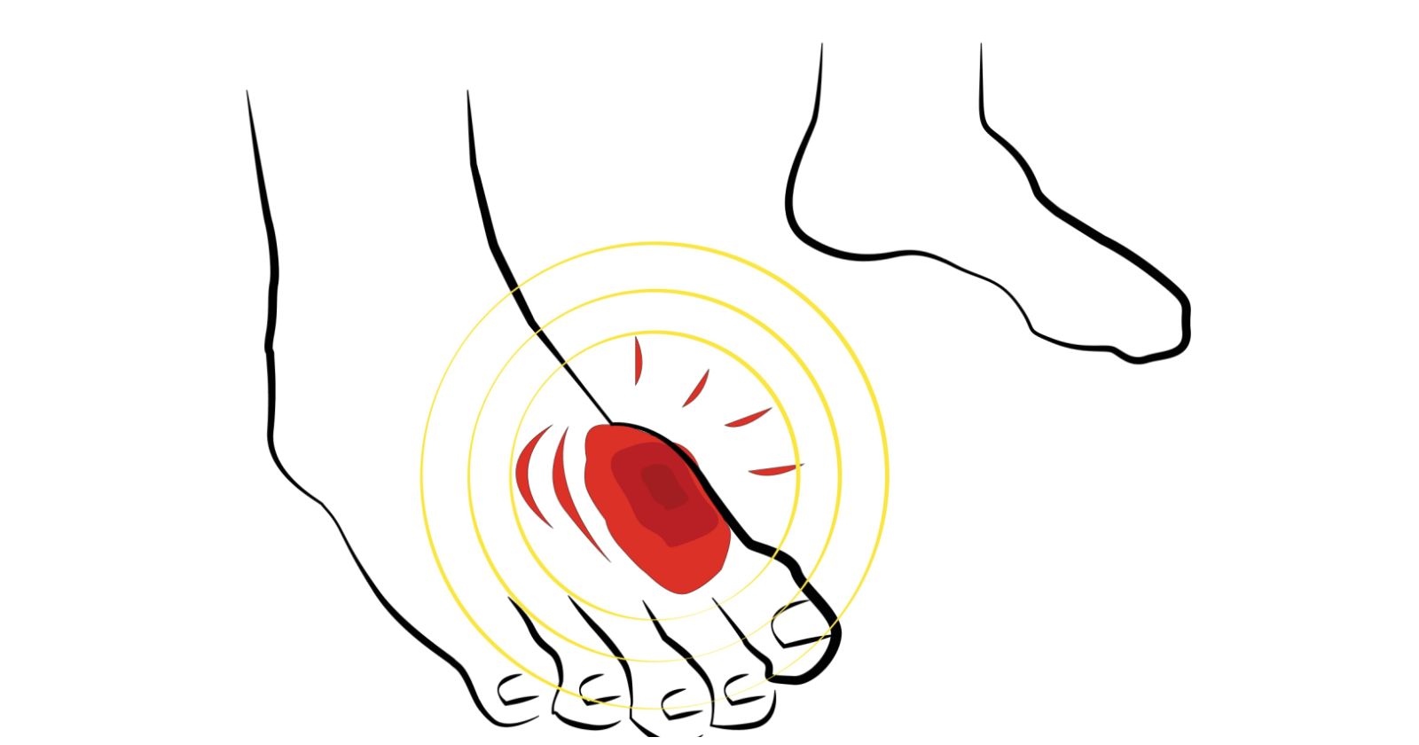 First Aid for Puncture Wounds Types, Signs & Quick Action