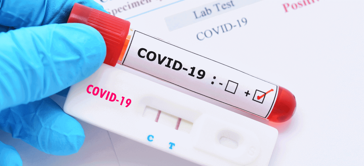 COVID-19 Test for Free of Cost in India