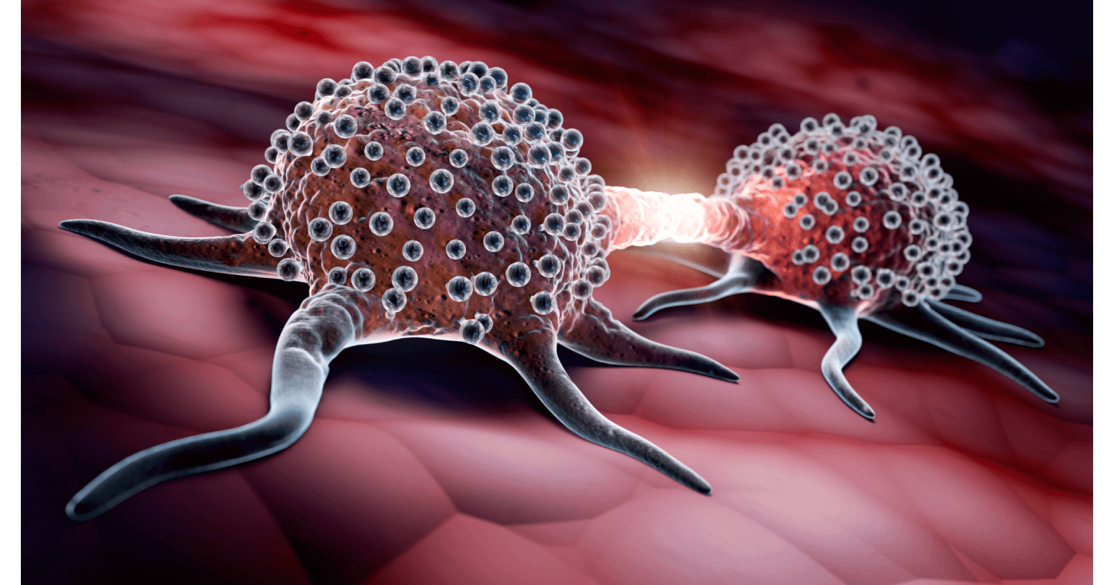 Carcinoid Tumour: Symptoms, Causes, Treatment & Prevention