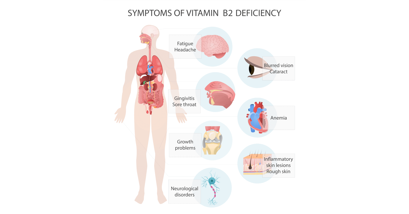 Learn About the Causes and Symptoms of Vitamin B2 Deficiency