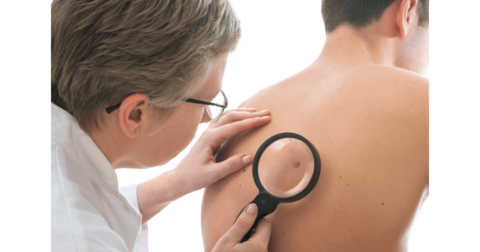 Understanding Skin Tumour: Types, symptoms, causes and treatment