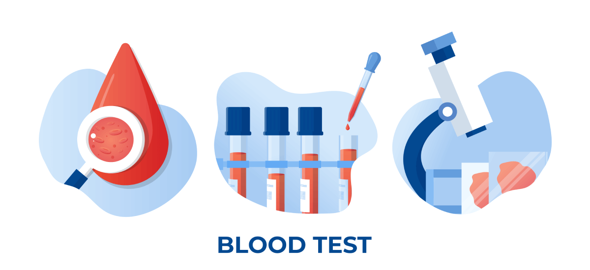 All you need to know about MCHC Blood Tests