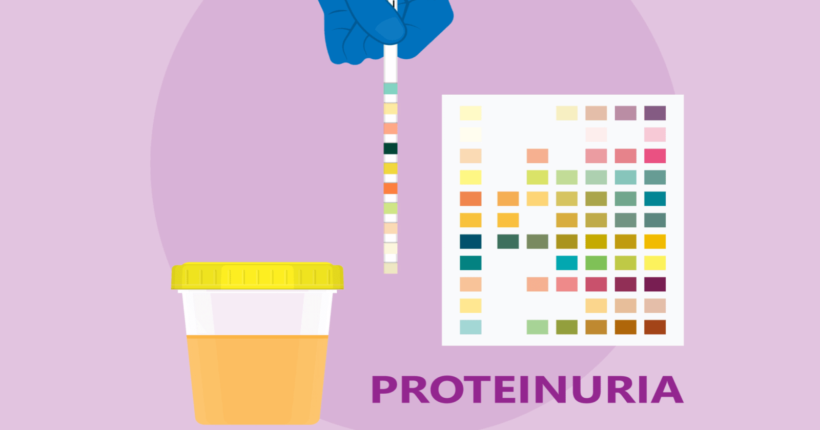 Protein in urine (Proteinuria): Meaning, symptoms, causes, and other details
