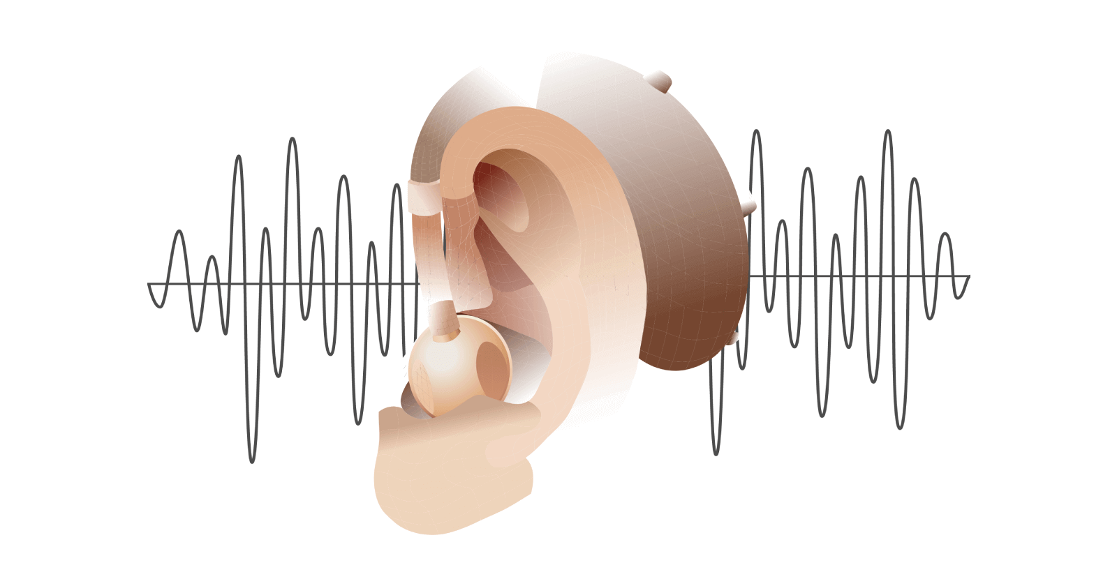 Does Medical Insurance Cover Hearing Aids?