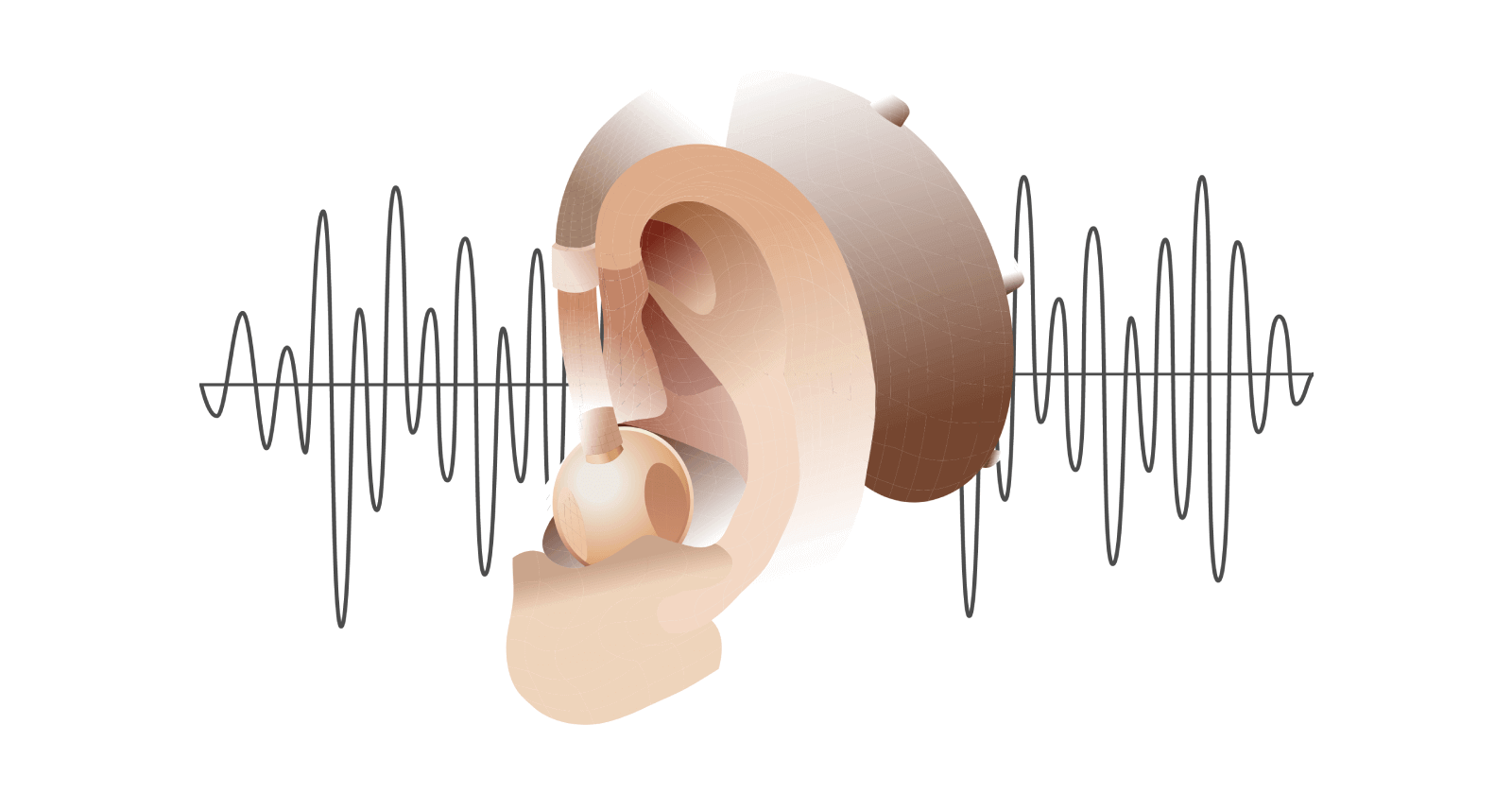 Does medical insurance cover hearing aids?