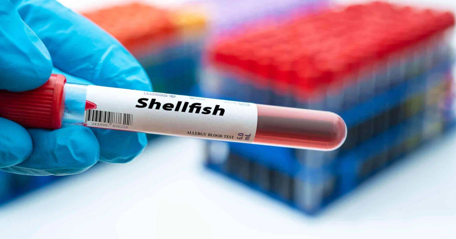 Living with a Shellfish Allergy: Causes, Symptoms & Treatments