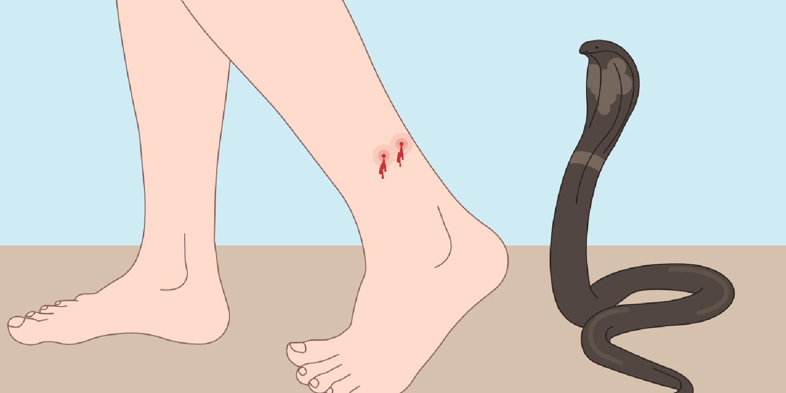 First Aid for Snakebite Effects, Treatment & Symptoms