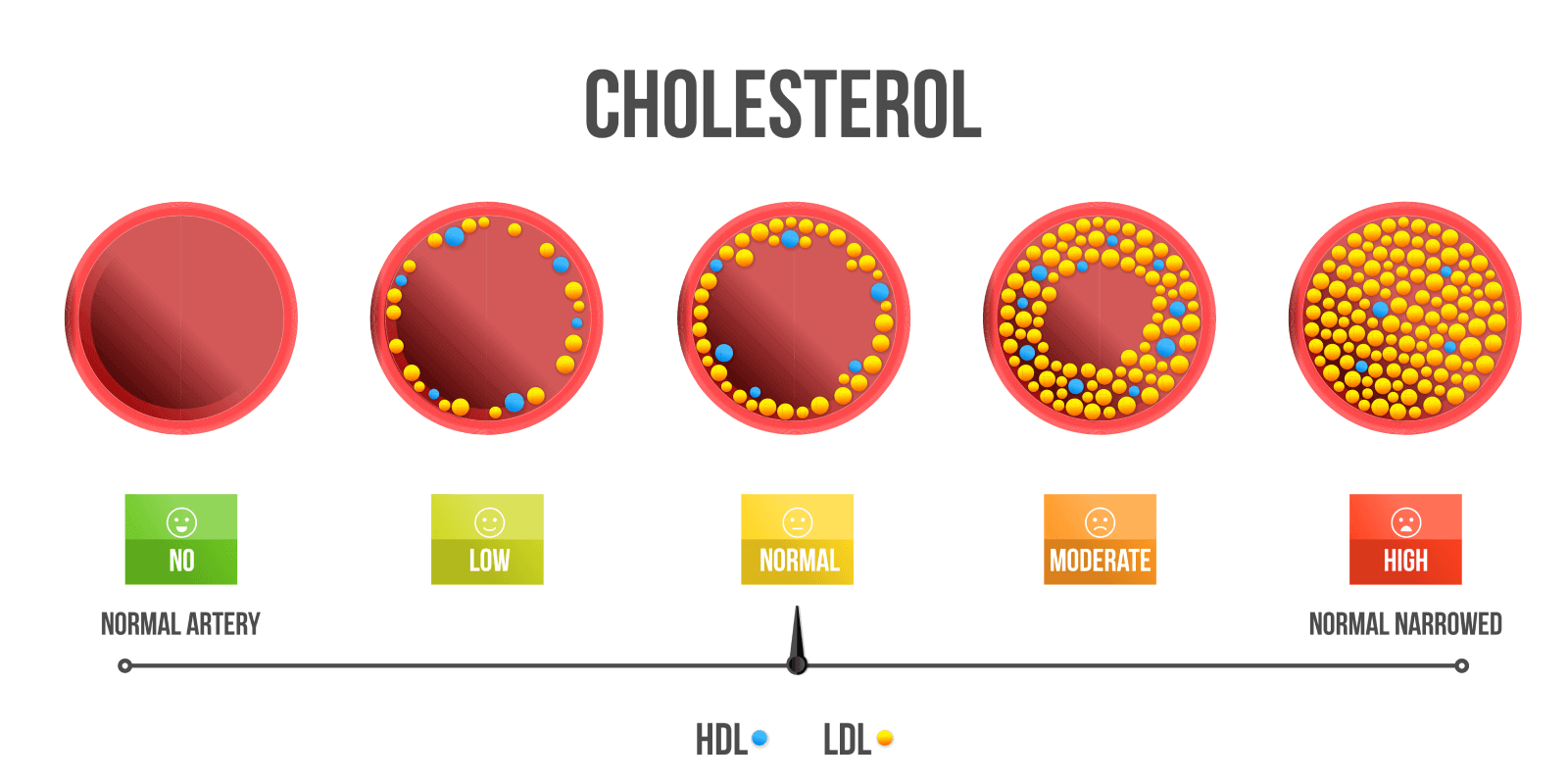 High Cholesterol Overview, Types,Symptoms, Causes, Levels, & More