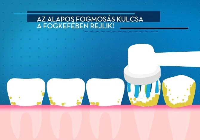 Image - Találja Meg 2019. Legjobb Elektromos Fogkeféjét Saját Részre - Main 