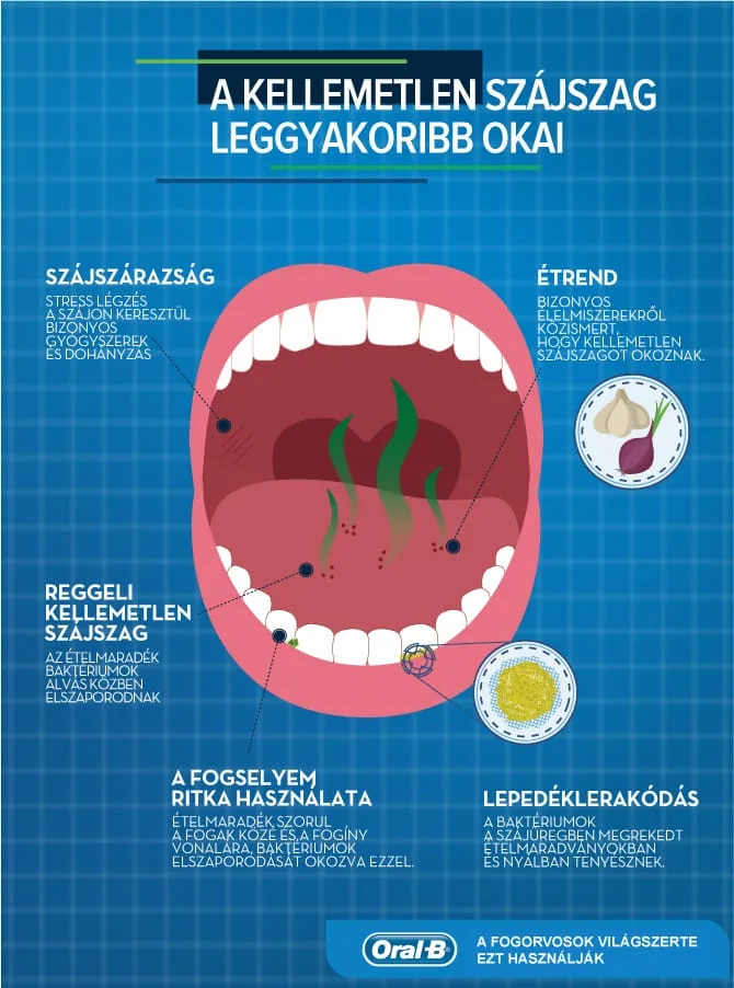 Számoljon le a kellemetlen szájszag (halitosis) okaival 