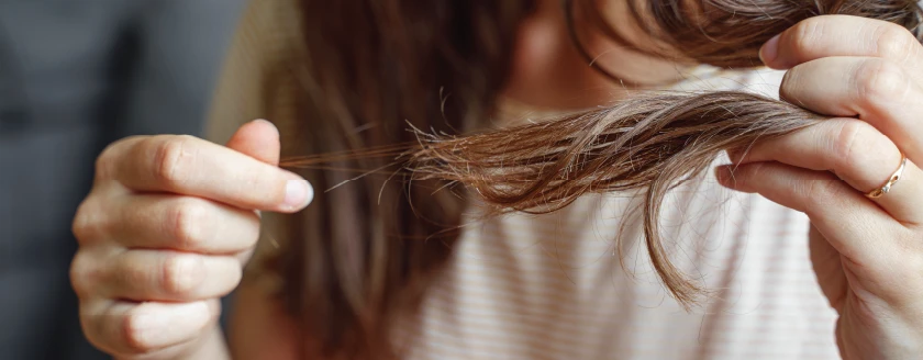 Chute des cheveux : cause et remèdes efficaces