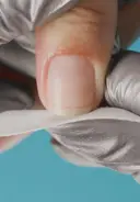 Scrub remaining residue using a lint-free wipe saturated with acetone