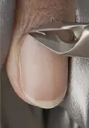 If needed, trim away any loose dead skin with a cuticle nipper