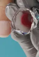 After 20 minutes, check the progress of removal one nail at a time