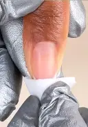 Cleanse nails with a nail wipe saturated with N.A.S. 99 Cleansing Solution