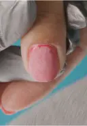 File off the top coat of the gel polish and break the seal on the free edge using a 180-grit file