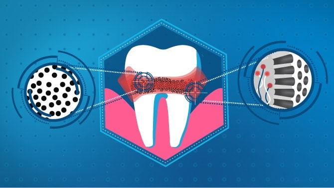 Co znamenají citlivé zuby a obnaþená zubovina 