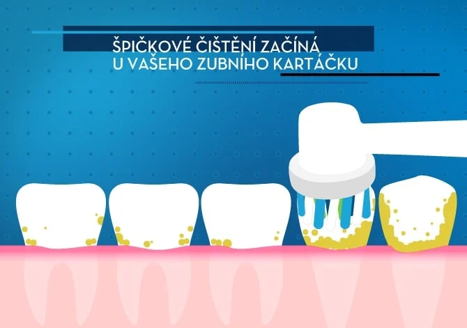 Jak si vybrat nejlepáí Oral-B elektrický zubní kartáček 