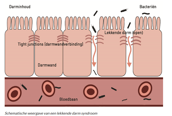 Image: lekkende darmsydroom