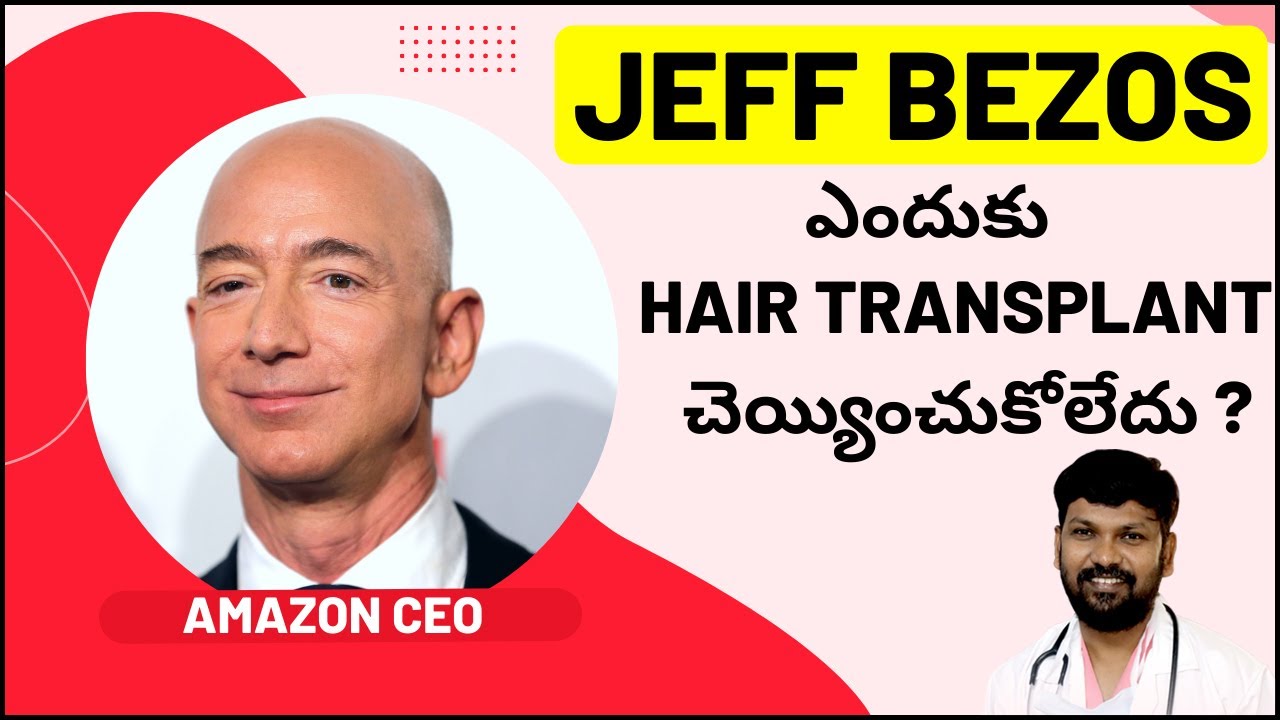 Why the World’s Richest Man Jeff Bezos Never Got a Hair Transplant