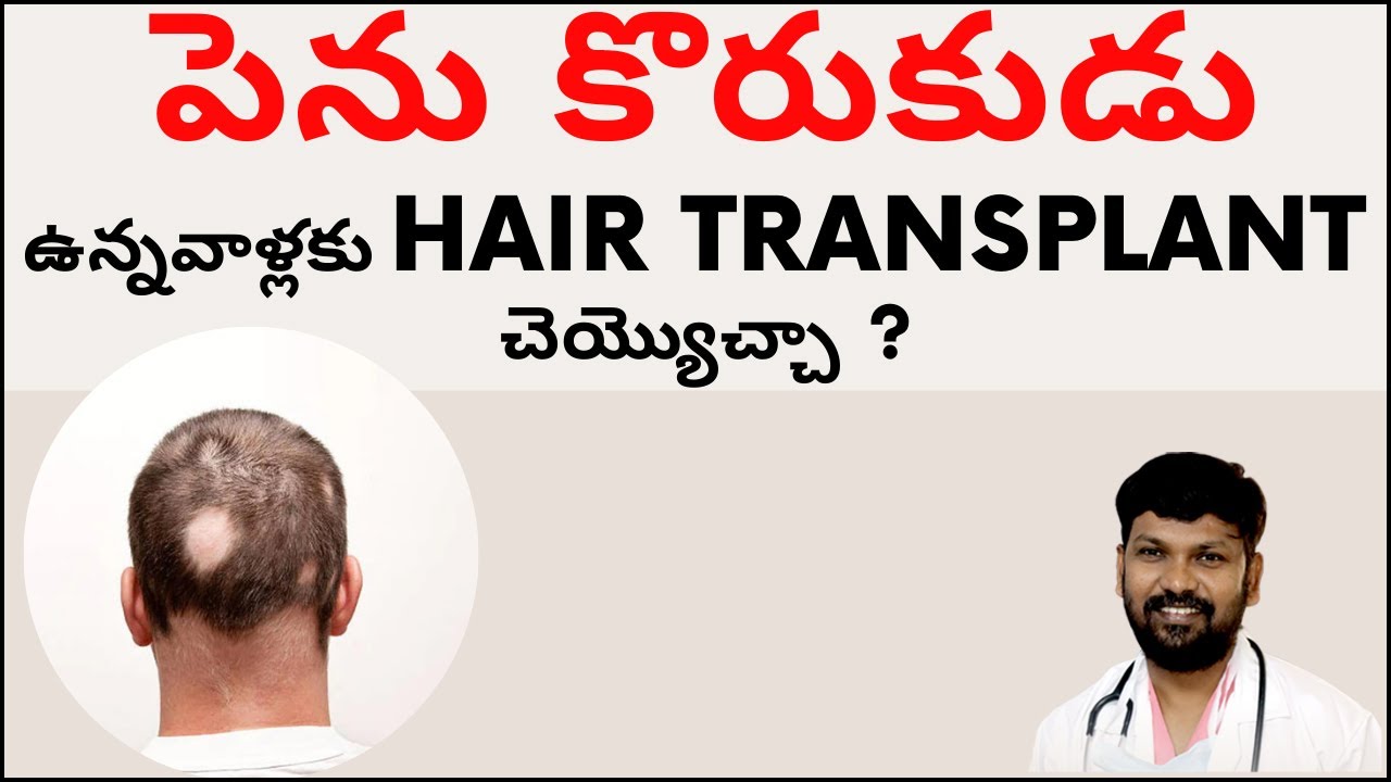 Hair Transplant Vs Hair Patch: Which is Better if Hair Loss is in a Small Area?