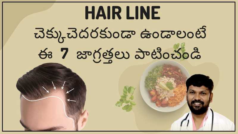 7 Steps to Prevent Hairline Receding