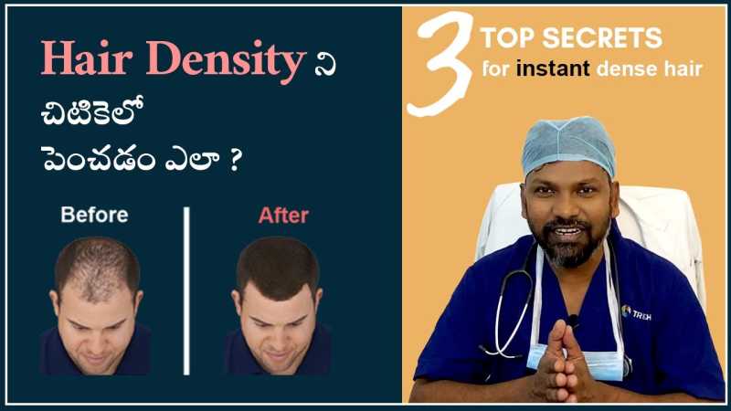 Top 3 Secrets to Instantly Increase Hair Density
