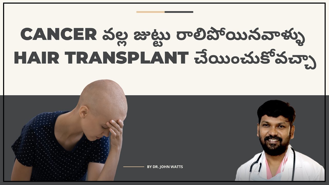 Hair Transplant for Chemotherapy Patients