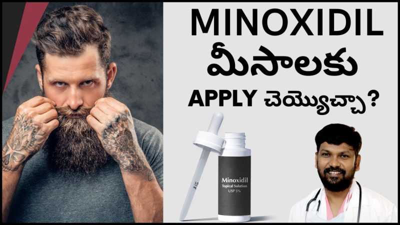 Can You Apply Minoxidil for moustache?