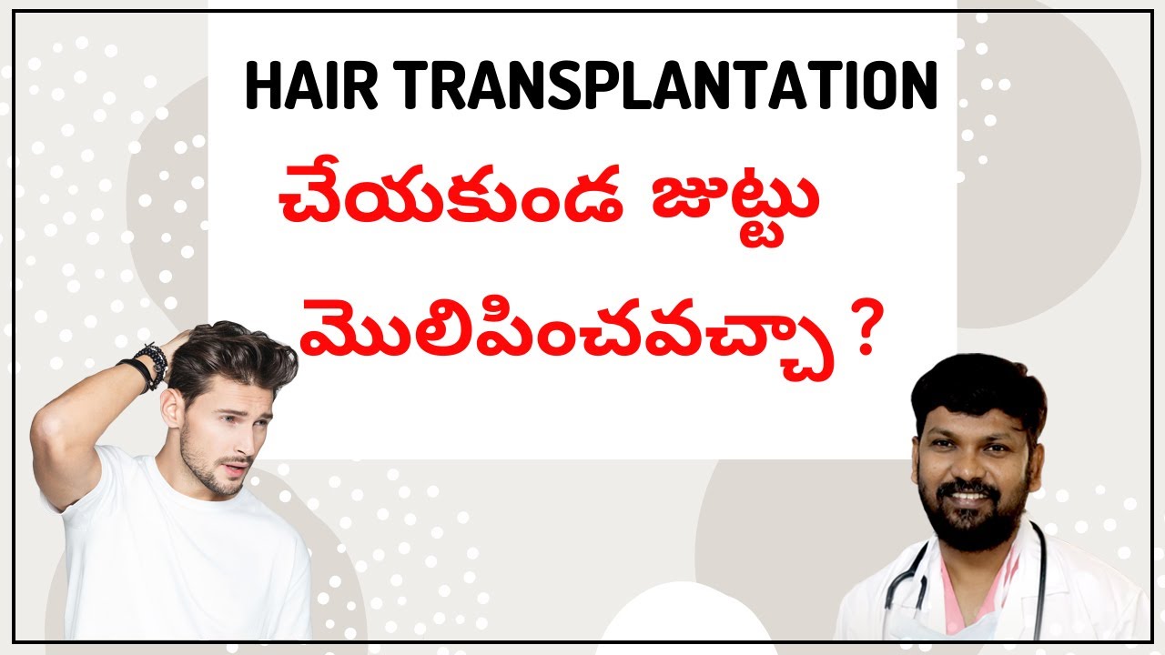 FAQs on Hair Transplants