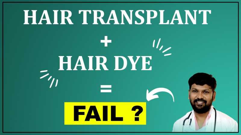 How Soon Can You Get a Hair Dye After a Hair Transplant?