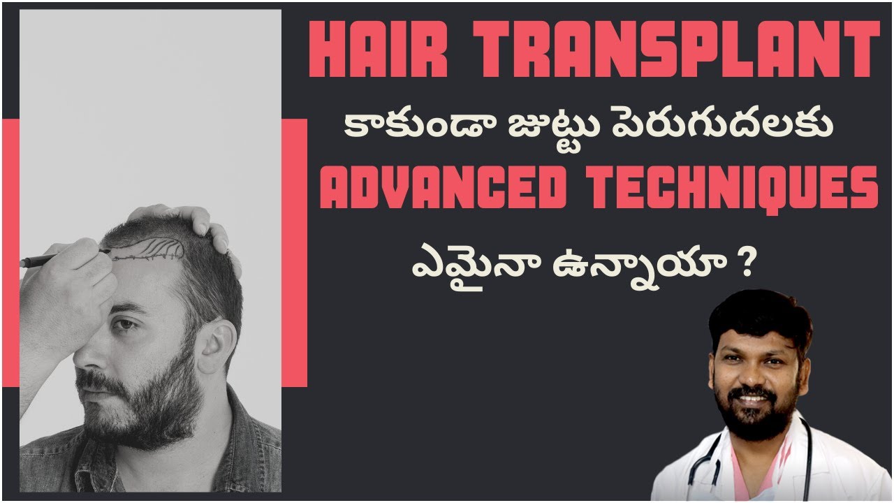 Besides hair transplant procedure, is there any other advanced procedure for hair growth?