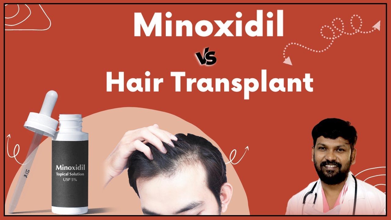 Frequently Asked Questions about  Hair Transplant