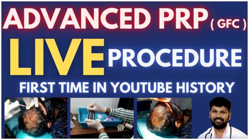 Live Advanced PRP ( GFC ) Procedure