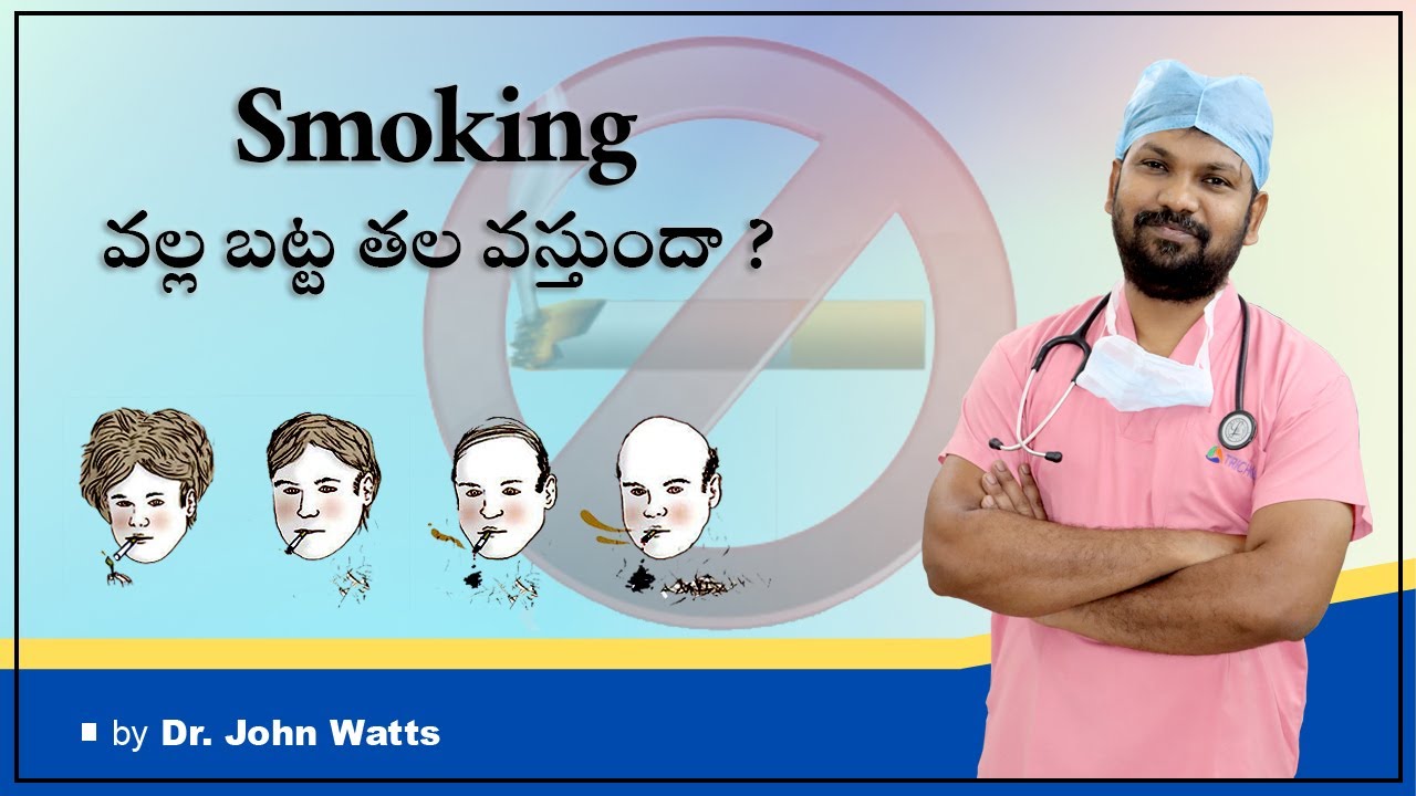  Does Smoking Cause Baldness?