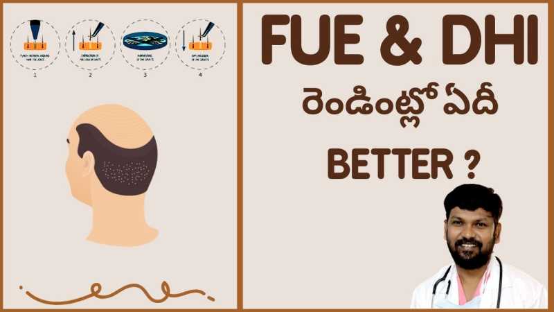 Between FUE or DHI, which is a better hair transplant technique? Which would give better results?