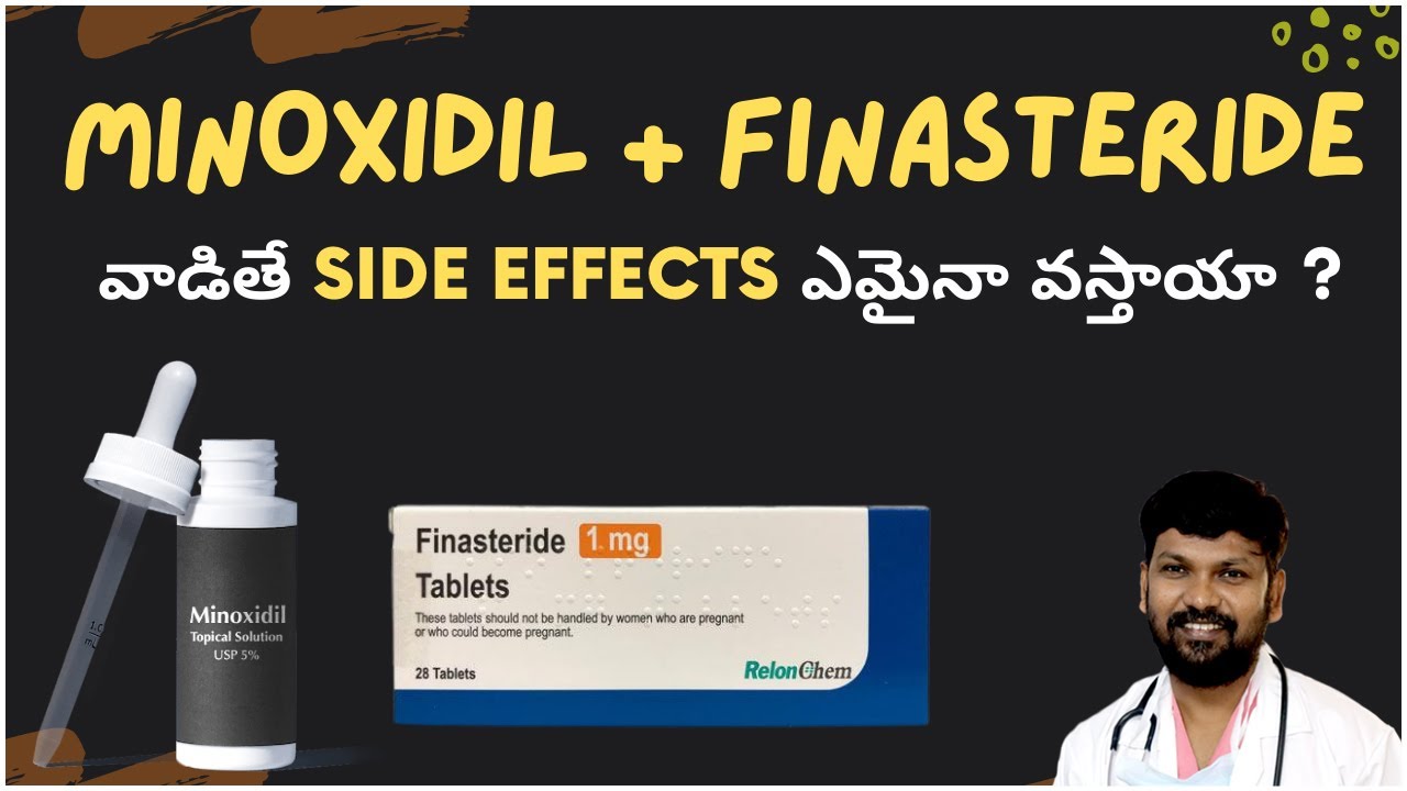 Should You Use Minoxidil and Finasteride Singly or in Combination?