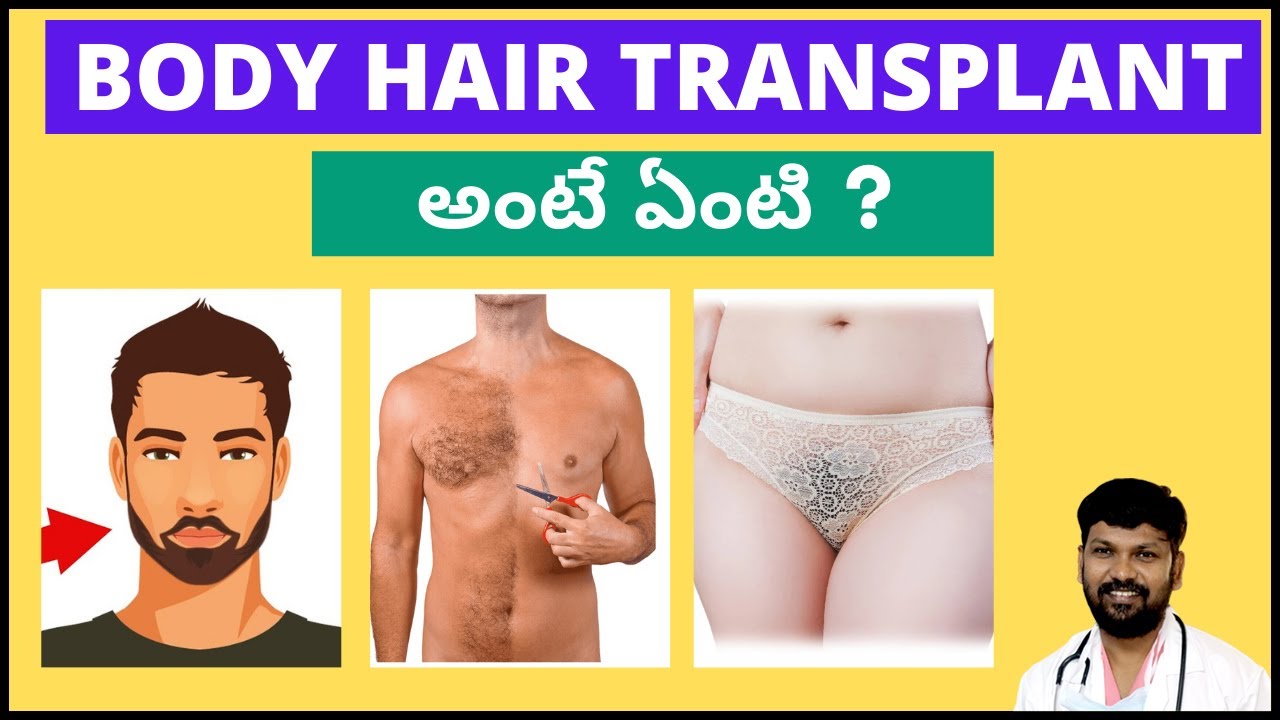 Is Body Hair Transplant as Good as Scalp Hair Transplant?