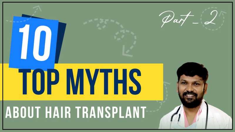 Top 10 Hair Transplant Myths: Part 2