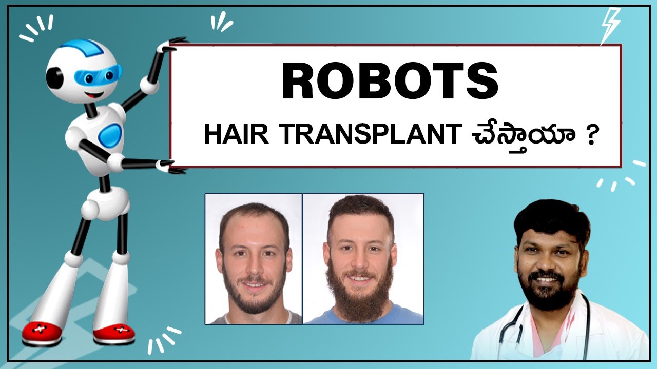 Robotic Hair Transplant | Uses & Disadvantages