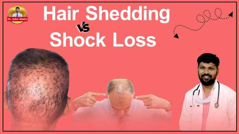 Shock Hair Loss & Hair Shedding