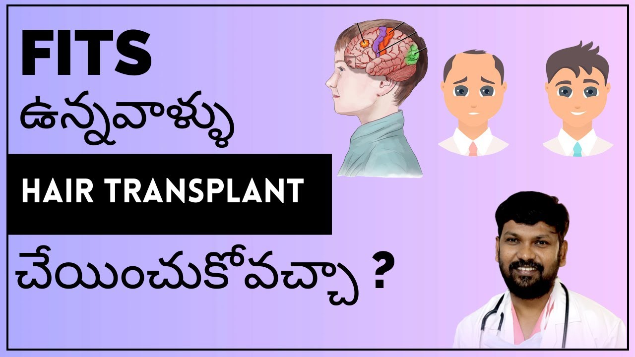 Hair Transplant in Epilepsy/Fits Patients?