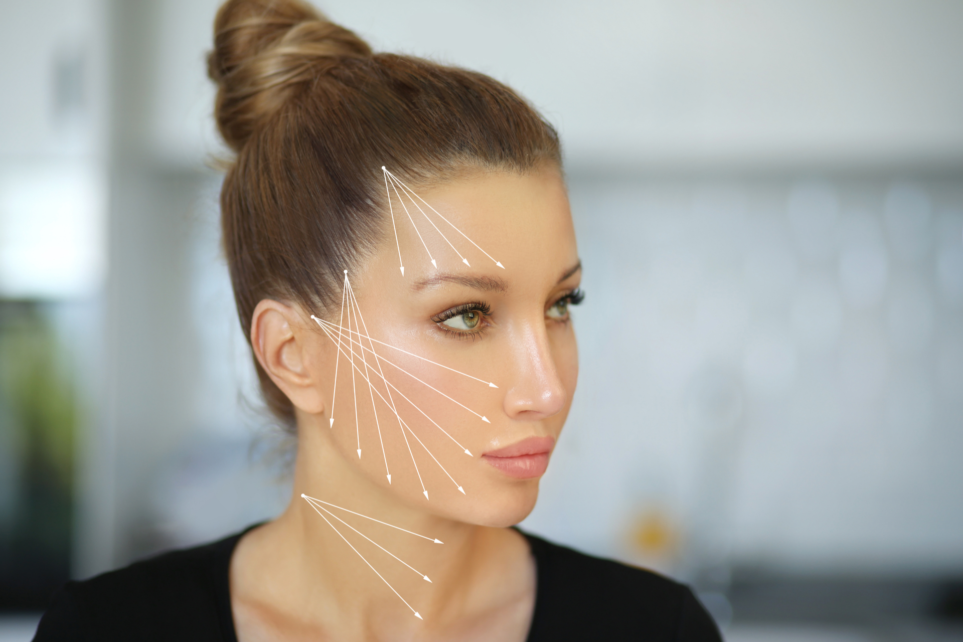 Ein Überblick über die Methode sowie Fadenlifting Kosten