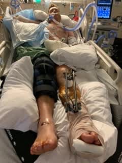 Carter Viss in hospital